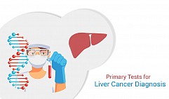 Liver Cancer Diagnosis